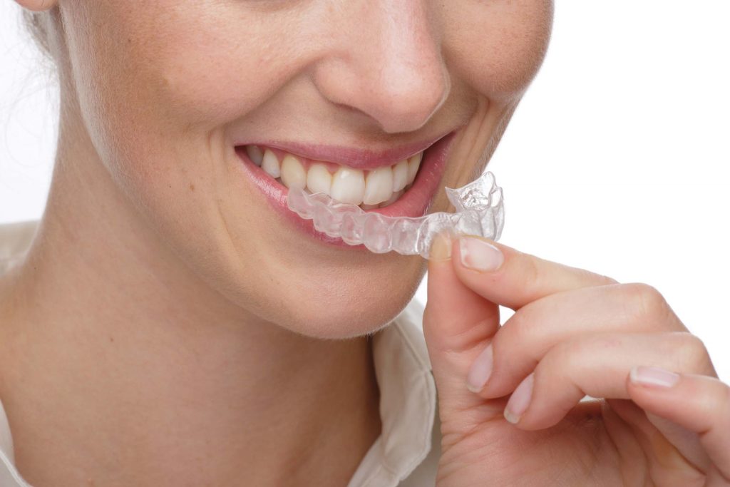illustration urgences Une personne souriante tient un aligneur dentaire transparent et lamène à ses dents. Elle porte une chemise blanche et lattention est portée sur laligneur et son sourire, démontrant ainsi son utilisation.