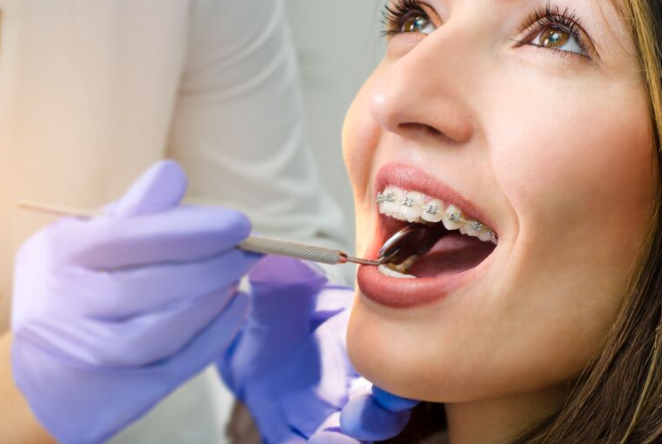 illustration urgences Une jeune femme portant un appareil dentaire passe un examen dentaire. Elle est assise sur une chaise, la bouche ouverte, tandis quun dentiste, portant des gants violets, utilise un miroir dentaire et une sonde pour examiner ses dents.
